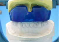 後藤吉平歯科のマウスガード